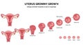 Illustration showing a sequence of uterine development stages during pregnancy. The Royalty Free Stock Photo