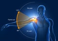 Shoulder Impingement, Painfull Arc, 3D Illustration Royalty Free Stock Photo