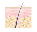 Illustration showing the structure of the epidermis and dermis.Not notation