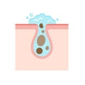 Illustration of skin care , skin cleaning (cross section of skin) cleaning pores