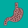 Illustration of the stomach ulcers.