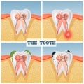 Illustration of tooth anatomy Royalty Free Stock Photo