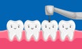 Illustration of tooth drilled by dental drill.