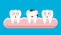 Illustration of tooth sectional view decay with caries dental health problem