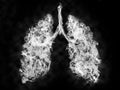 Illustration of a toxic smoke in Lung . lung cancer concept