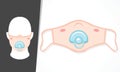 Illustration Vector Graphic Of Cute Baby Mouth Using Pacifier In Mask Design