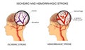 Illustration of the vessels of the brain