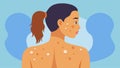 An illustration of a womans back first with visible acne scars and marks and the second with a clear and blemishfree Royalty Free Stock Photo