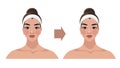 Before and after, illustrations for a beauty salon, cosmetic procedures, plastic surgery, facial massage, lymphatic Royalty Free Stock Photo