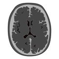 Illustrative picture of normal Ct scan of head of human brain.