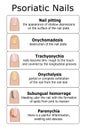 Ilustration of psoriatic nails