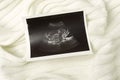Image of baby during ultrasound examination on white soft fabric background Royalty Free Stock Photo
