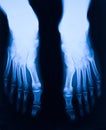 Foot xray