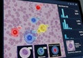 Statistical information, while close-up images of cells like Monocytes, Royalty Free Stock Photo