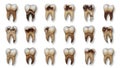 Dental teeth models, isolated on white background Royalty Free Stock Photo