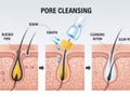 Pore cleansing process isolated on white background Royalty Free Stock Photo