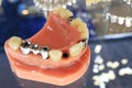 The image of the model of the human jaw and dentures. Royalty Free Stock Photo