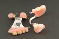 Large image of a modern arc denture with attachmens Royalty Free Stock Photo