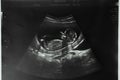 Image of mother`s womb ultrasound during pregnancy. Ultrasound of a fetus at 12 weeks 6 days Royalty Free Stock Photo