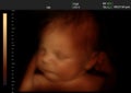Image of a newborn baby like 3D ultrasound Royalty Free Stock Photo