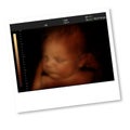 Image of newborn baby like 3D ultrasound of baby in mother's wom