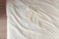 Image of pee on the white bed sheet. Cause stains and dirty on the mattress.