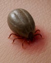 The tick bit into the human skin Royalty Free Stock Photo