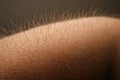 Closeup of hairy human arm with skin and hair follicles detail. macro anatomical photography Royalty Free Stock Photo