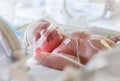 Image of the premature baby in incubator Royalty Free Stock Photo