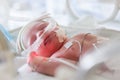 Image of the premature baby in incubator