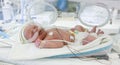 Image of the premature baby in incubator Royalty Free Stock Photo