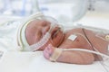 Image of the premature baby in incubator