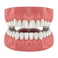 A detailed illustration of a dental prosthetic with a missing molar tooth replacement Royalty Free Stock Photo