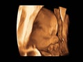 Image Ultrasound 3D, 4D of baby in mother womb Royalty Free Stock Photo
