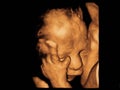 Image Ultrasound 3D, 4D of baby in mother womb Royalty Free Stock Photo