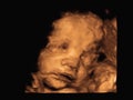 Image Ultrasound 3D4D of baby in mother`s womb