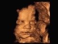 Image Ultrasound 3D4D of baby in mother`s womb