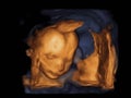 Image Ultrasound 3D, 4D of baby in mother womb Royalty Free Stock Photo