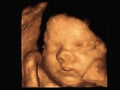 Image Ultrasound 3D4D of baby in mother`s womb