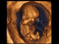 Image Ultrasound 3D, 4D of baby in mother womb