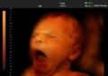 Image of a yawning newborn baby like 3D ultrasound Royalty Free Stock Photo