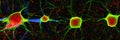 Close-up of stained neurons in nervous system