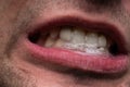 Image of young man with saliva, showing teeth