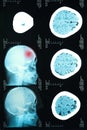 Images from a computerized tomography of the brain