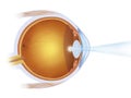 Laser treatment on the eye Royalty Free Stock Photo