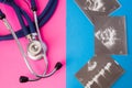 Imaginery of ultrasound test or examinations and medical stethoscope in two colors background: blue and pink. Concept of ultrasoun