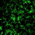 Imaging of breast cancer cells expressing Green Fluorescent Protein