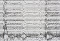 Imaging of electroencephalography recording of human