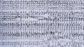 Imaging of ictal EEG recording in epilepsy patient