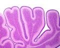 Immature cerebellum. External granular layer